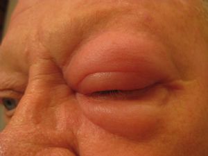 Click for Large Version